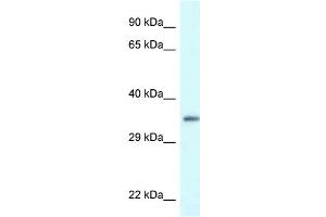 WB Suggested Anti-PDLIM1 Antibody Titration: 1. (PDLIM1 抗体  (C-Term))