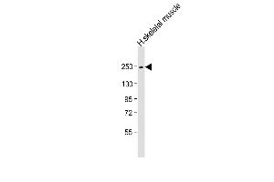 Anti-MYH4 Antibody (N-Term) at 1:1000 dilution + human skeletal muscle lysate Lysates/proteins at 20 μg per lane. (MYH4 抗体  (AA 346-380))