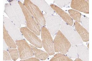 ABIN6266991 at 1/100 staining human Skeletal muscle tissue sections by IHC-P. (COL12A1 抗体  (Internal Region))