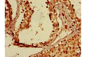 Immunohistochemistry of paraffin-embedded human testis tissue using ABIN7162843 at dilution of 1:100 (FKBP8 抗体  (AA 58-190))