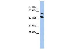 WB Suggested Anti-MMP24 Antibody Titration:  0. (MMP24 抗体  (Middle Region))