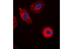 Immunofluorescent analysis of Galectin 8 staining in HepG2 cells. (LGALS8 抗体  (Center))