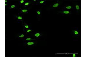 Immunofluorescence of purified MaxPab antibody to RCC1 on HeLa cell.