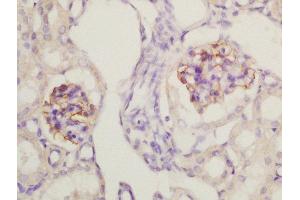 Formalin-fixed and paraffin embedded mouse kidney labeled with Rabbit Anti-Nephrin Polyclonal Antibody, Unconjugated (ABIN2177857) at 1:200 followed by conjugation to the secondary antibody and DAB staining (Nephrin 抗体  (AA 451-550))
