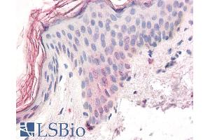 ABIN184890 (3. (ZIC5 抗体  (C-Term))