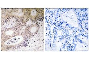 Immunohistochemistry (IHC) image for anti-Ribosomal Protein S6 Kinase, 90kDa, Polypeptide 5 (RPS6KA5) (Ser212) antibody (ABIN1848238)