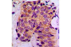 Immunohistochemistry (IHC) image for anti-Melanoma Antigen Family A, 1 (Directs Expression of Antigen MZ2-E) (MAGEA1) (C-Term) antibody (ABIN7296244)