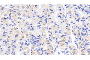 Detection of CK-BB in Human Stomach Tissue using Monoclonal Antibody to Creatine Kinase B (CK-BB) (CKB 抗体  (AA 11-367))
