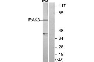 Immunohistochemistry analysis of paraffin-embedded human brain tissue using IRAK3 antibody. (IRAK3 抗体)
