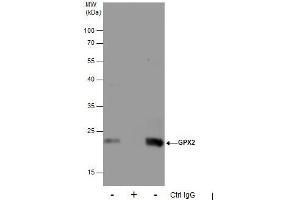 IP Image Immunoprecipitation of GPX2 protein from HepG2 whole cell extracts using 5 μg of GPX2 antibody [C1C3], Western blot analysis was performed using GPX2 antibody [C1C3], EasyBlot anti-Rabbit IgG  was used as a secondary reagent. (Glutathione Peroxidase 2 抗体  (C-Term))