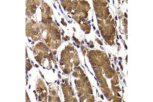 Immunohistochemistry of paraffin-embedded human stomach using STAMBP antibody at dilution of 1:100 (x400 lens). (STAMBP 抗体)
