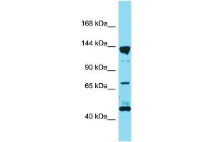 Western Blotting (WB) image for anti-Liprin alpha 3 (PPFIA3) (C-Term) antibody (ABIN2791058) (LIPA3 抗体  (C-Term))