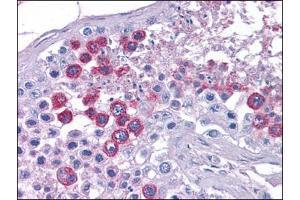 Immunohistochemistry (Paraffin-embedded Sections) (IHC (p)) image for anti-ATPase, Class VI, Type 11A (ATP11A) (N-Term) antibody (ABIN784089)