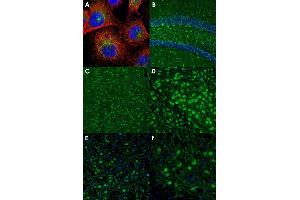 Immunofluorescent staining of U-251 MG (A), mouse dentate gyrus (B), mouse cingulate cortex (C), mouse thalamus (D), mouse motor trigeminal nucleus (E) and mouse brain (F) with ARHGAP1 polyclonal antibody  (Green). (ARHGAP1 抗体)