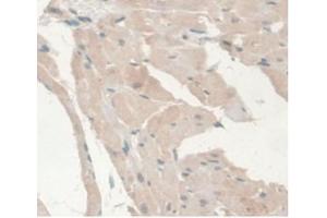 IHC-P analysis of Rat Heart Tissue, with DAB staining. (Androgen Receptor 抗体  (AA 491-679))
