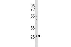 OSCAR antibody western blot analysis in 293 lysate. (OSCAR 抗体  (AA 205-231))