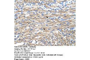 Rabbit Anti-MBNL1 Antibody  Paraffin Embedded Tissue: Human Heart Cellular Data: Myocardial cells Antibody Concentration: 4. (MBNL1 抗体  (Middle Region))