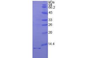 Image no. 1 for Interleukin 1 Receptor, Type I (IL1R1) (AA 21-109) (Active) protein (His tag) (ABIN6239813)