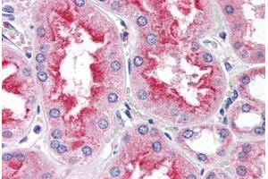 Human Kidney (formalin-fixed, paraffin-embedded) stained with SMAD9 antibody ABIN337365 at 5 ug/ml followed by biotinylated anti-goat IgG secondary antibody ABIN481715, alkaline phosphatase-streptavidin and chromogen. (SMAD9 抗体  (AA 166-179))