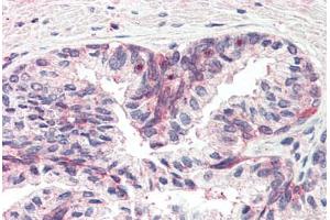 Human Prostate (formalin-fixed, paraffin-embedded) stained with MSX1 antibody ABIN337116 at 2. (MSX1 抗体  (AA 8-19))