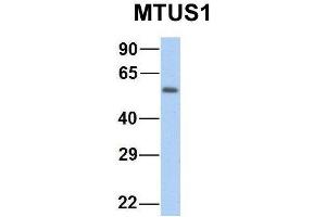 Host:  Rabbit  Target Name:  GNAS  Sample Type:  Human Fetal Heart  Antibody Dilution:  1.