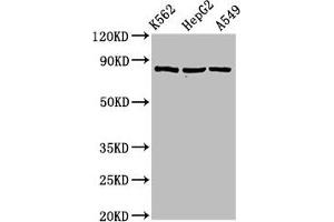 Western Blot Positive WB detected in: K562 whole cell lysate, HepG2 whole cell lysate, A549 whole cell lysate All lanes: HSP90AB1 antibody at 2 μg/mL Secondary Goat polyclonal to rabbit IgG at 1/50000 dilution Predicted band size: 84 kDa Observed band size: 84 kDa (HSP9AB1 (AA 150-355) 抗体)