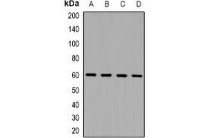 Western blot analysis of NOX1 expression in Hela (A), HEK293T (B), NIH3T3 (C), Mouse kidney (D) whole cell lysates. (NOX1 抗体)