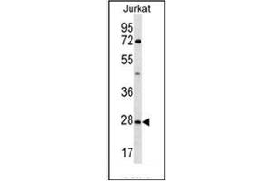 Western blot analysis of OR6T1 Antibody (C-term) in Jurkat cell line lysates (35ug/lane). (OR6T1 抗体  (C-Term))