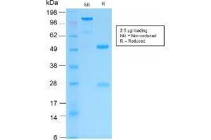 SDS-PAGE Analysis Purified Cytokeratin 16 Rabbit Recombinant Monoclonal Antibody (KRT16/2043R). (Recombinant KRT16 抗体  (C-Term))