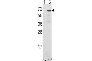 Western Blotting (WB) image for anti-Calcium/calmodulin-Dependent Protein Kinase Kinase 1, alpha (CAMKK1) antibody (ABIN3003480) (CAMKK1 抗体)