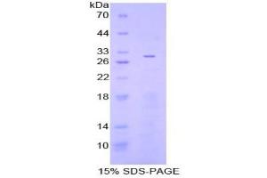 SDS-PAGE analysis of Human Adenylate Cyclase 3 Protein. (ADCY3 蛋白)