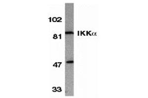 Western Blotting (WB) image for anti-conserved Helix-Loop-Helix Ubiquitous Kinase (CHUK) antibody (ABIN1030202) (IKK alpha 抗体)