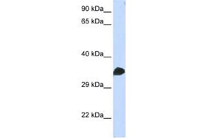 WB Suggested Anti-CDC2 Antibody Titration:  0. (CDK1 抗体  (N-Term))