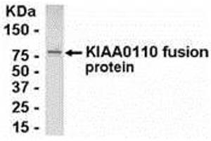Western Blotting (WB) image for anti-MAD2L1 Binding Protein (MAD2L1BP) (AA 1-126) antibody (ABIN2468117) (MAD2L1BP 抗体  (AA 1-126))