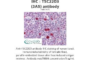 Image no. 2 for anti-TSC22 Domain Family, Member 3 (TSC22D3) (AA 1-98) antibody (ABIN1723461) (TSC22D3 抗体  (AA 1-98))