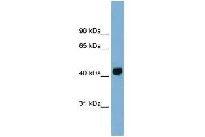 WB Suggested Anti-KIAA1704 Antibody Titration: 0. (GPALPP1 抗体  (Middle Region))