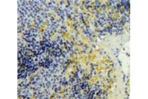 #VALUE! (PF4 抗体  (AA 25-105))