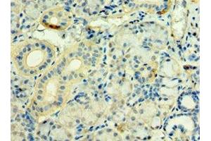 Immunohistochemistry of paraffin-embedded human pancreatic tissue using ABIN7171263 at dilution of 1:100 (STXBP3 抗体  (AA 343-592))