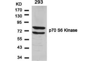 Image no. 3 for anti-Ribosomal Protein S6 Kinase, 70kDa, Polypeptide 1 (RPS6KB1) (Ser424) antibody (ABIN197548) (RPS6KB1 抗体  (Ser424))