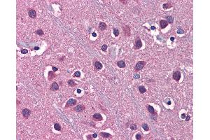 Anti-SLC1A2 / EAAT2 antibody IHC of human brain, cortex.