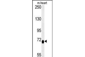LCA5L Antibody (C-term) (ABIN653975 and ABIN2843921) western blot analysis in mouse heart tissue lysates (15 μg/lane). (LCA5L 抗体  (C-Term))