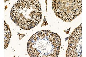 ABIN7095488 and ABIN7099545 at 1/100 staining mouse testis tissue by IHC-P. (UBXN7 抗体)