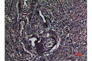 Immunohistochemistry (IHC) analysis of paraffin-embedded Human uterus, antibody was diluted at 1:100.