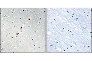 Immunohistochemistry analysis of paraffin-embedded human brain tissue, using ZNF596 Antibody. (ZNF596 抗体  (AA 261-310))