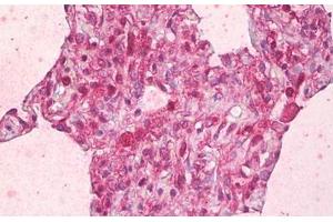 Anti-ABCB7 antibody IHC staining of human lung, alveoli. (ABCB7 抗体  (AA 691-740))