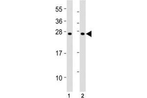 Western blot testing of SOCS1 antibody at 1:2000 dilution.