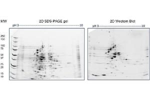 2D SDS-PAGE: Load/Strip: 100 μg E. (Combined Host Cell Proteins 抗体)