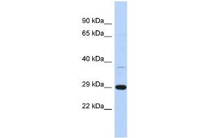 WB Suggested Anti-C1orf74 Antibody Titration: 0. (C1ORF74 抗体  (N-Term))