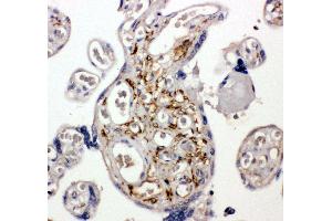 Anti-BAG5 antibody, IHC(P) IHC(P): Human Placenta Tissue (BAG5 抗体  (C-Term))