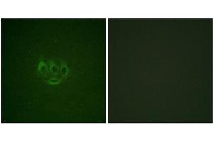 Immunofluorescence staining of methanol-fixed A549 cells using ACK1 (Phospho-Tyr284) Antibody. (TNK2 抗体  (pTyr284))